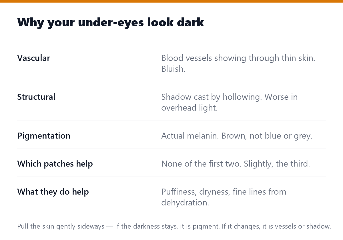Why your under-eyes look dark